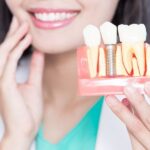 article_32490188_gallery_1776498341726